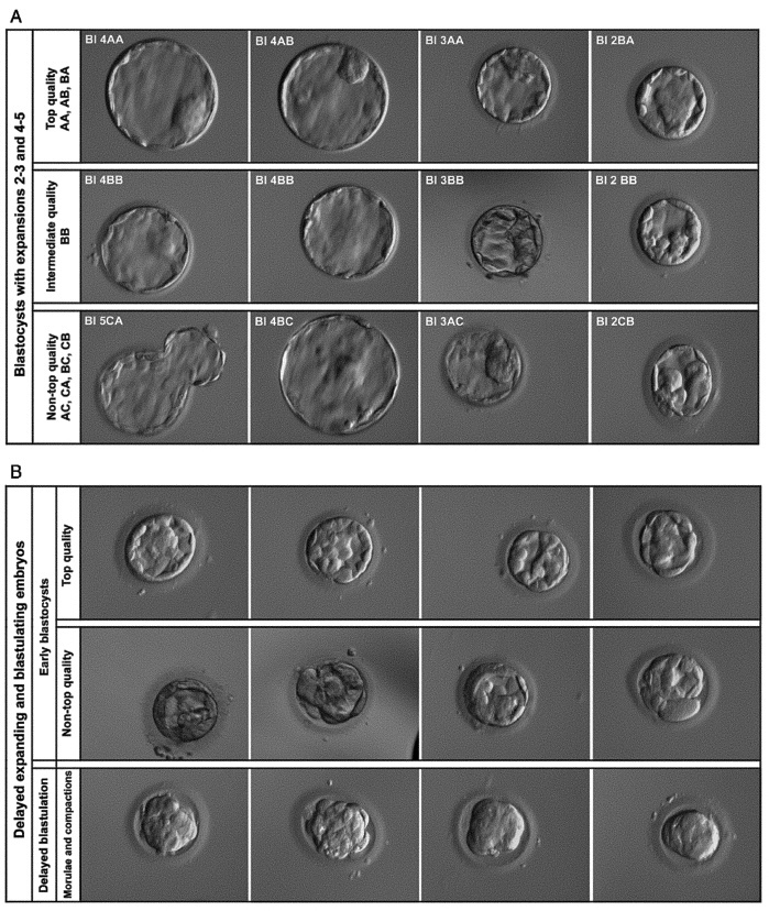 The grading of embryos